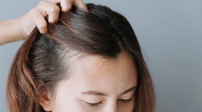 Postpartum Hair Loss: 5 Home Remedies Every New Mom Should Try